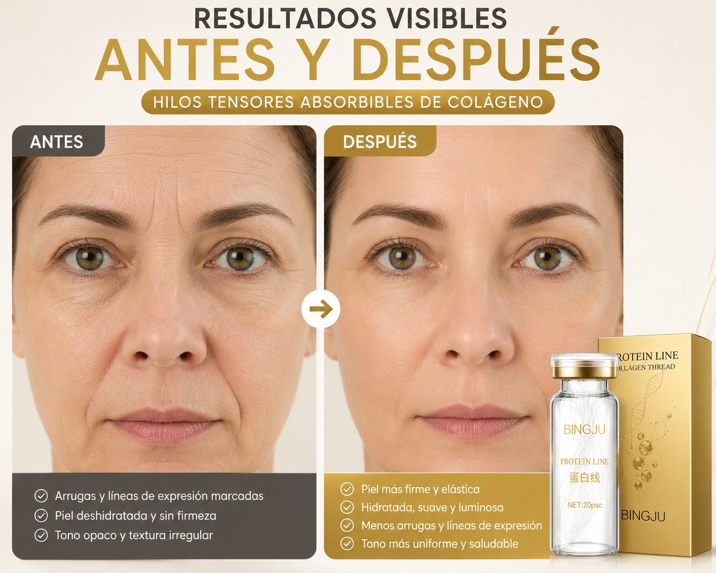 Set de Hilos Tensores Absorbibles de Colágeno + Sérum Facial de Regalo 🎁